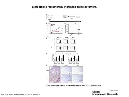 Stereotactic radiotherapy increases Tregs in tumors.