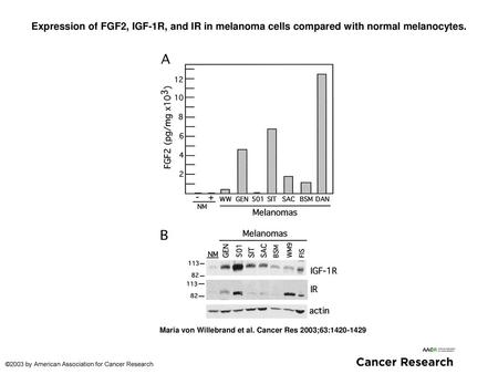 Expression of FGF2, IGF-1R, and IR in melanoma cells compared with normal melanocytes. Expression of FGF2, IGF-1R, and IR in melanoma cells compared with.