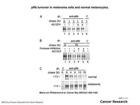 pRb turnover in melanoma cells and normal melanocytes.