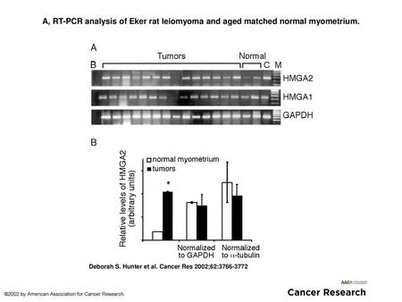 A, RT-PCR analysis of Eker rat leiomyoma and aged matched normal myometrium. A, RT-PCR analysis of Eker rat leiomyoma and aged matched normal myometrium.