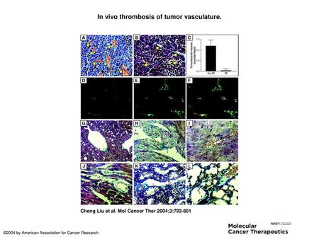 In vivo thrombosis of tumor vasculature.