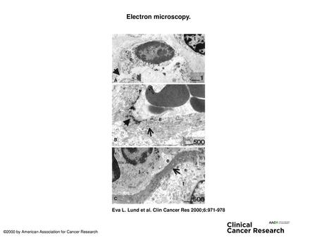 Electron microscopy. Electron microscopy. A, 8 h after irradiation. An endothelial cell is seen protruding into the lumen of the vessel. Arrow head, a.