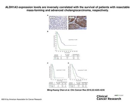 ALDH1A3 expression levels are inversely correlated with the survival of patients with resectable mass-forming and advanced cholangiocarcinoma, respectively.