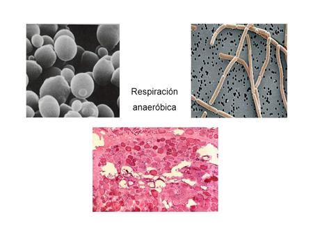 Respiración anaeróbica.