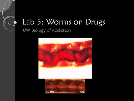 UW Biology of Addiction