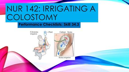 Nur 142: irrigating a colostomy