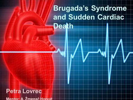 Brugada’s Syndrome and Sudden Cardiac Death