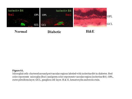 OPL GCL OPL GCL Normal Diabetic Isolectin B4 Iba1 Isolectin B4 Iba1 GCL OPL H&E Figure S1. Micorglial cells clustered around perivascular regions labeled.