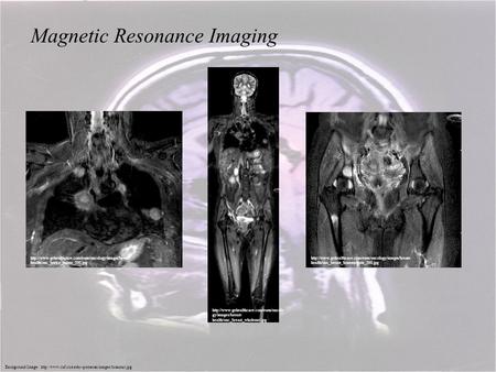 Magnetic Resonance Imaging