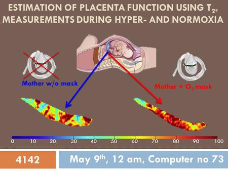 ESTIMATION OF PLACENTA FUNCTION USING T 2* MEASUREMENTS DURING HYPER- AND NORMOXIA May 9 th, 12 am, Computer no 73 Mother + O 2 mask Mother w/o mask 4142.