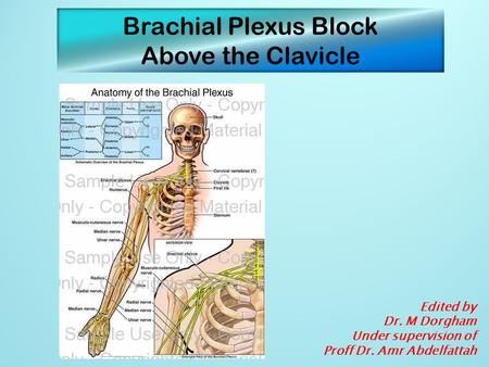 Brachial Plexus Block Above the Clavicle Edited by Dr. M Dorgham