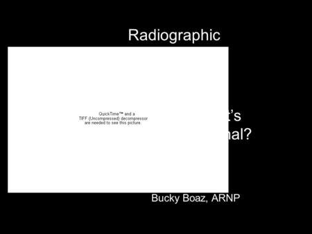 Radiographic Interpretation