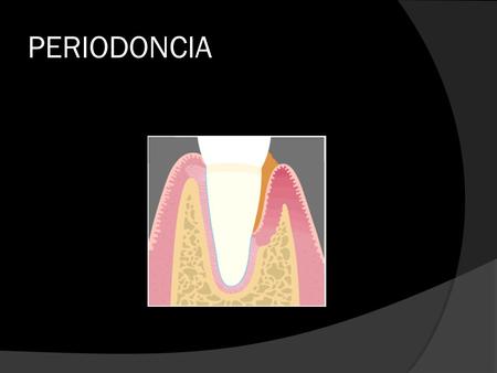 PERIODONCIA.