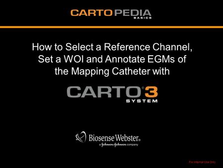 Selecting a Reference Channel