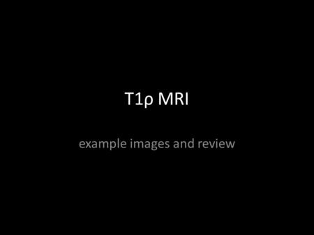 T1ρ MRI example images and review. T1rho MRI Hershey Medical Center 9/15/13 There is moderate B 0 field heterogeneity in this image. This field heterogeneity.