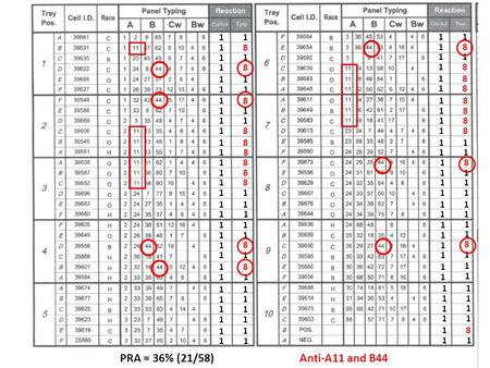1 1 8 1 1 8 1 8 1 1 8 1 1 8 1 1 8 1 1 1 8 1 1 8 1 1 1 1 8 PRA = 36% (21/58) Anti-A11 and B44.