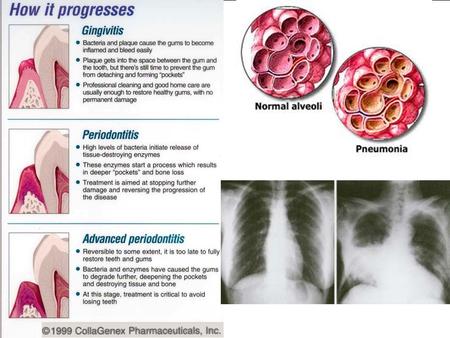 Copyright © 2011 Wolters Kluwer Health | Lippincott Williams & Wilkins.