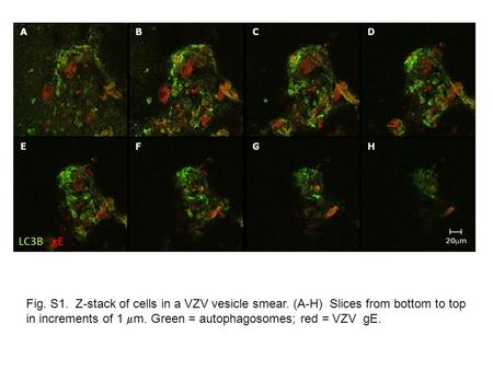 Fig. S1. Z-stack of cells in a VZV vesicle smear. (A-H) Slices from bottom to top in increments of 1  m. Green = autophagosomes; red = VZV gE. LC3B gE.