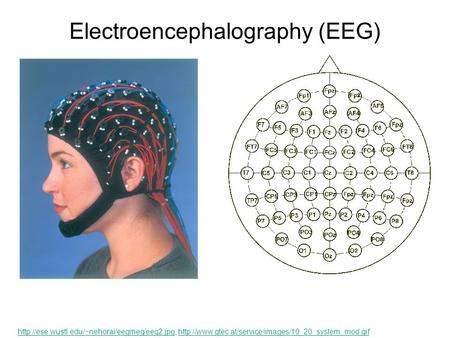 Electroencephalography (EEG)