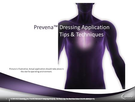 1 © 2010 KCI Licensing, Inc. For KCI Internal Training Use Only. Do Not Copy. Do Not Distribute. DSL#10-0349 (06/10) Prevena™ Q2 Marketing Update Amy Torrecillas.