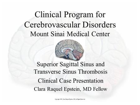 Superior Sagittal Sinus and Transverse Sinus Thrombosis