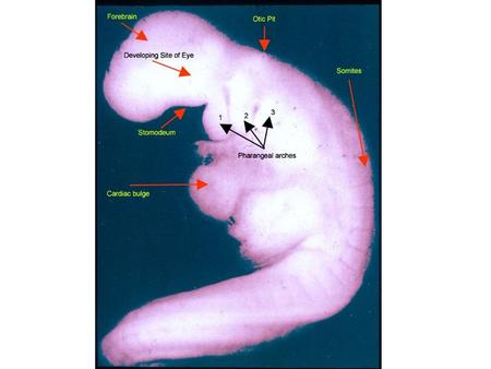 FACE AND SKULL: 01 26 DAY EMBRYO. Identify the following: OTIC PIT, 1ST, 2ND, 3RD PHARYNGEAL ARCHES, FOREBRAIN, SITE OF DEVELOPING EYE, STOMODEUM, CARDIAC.