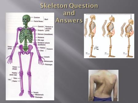 Skeleton Question and Answers