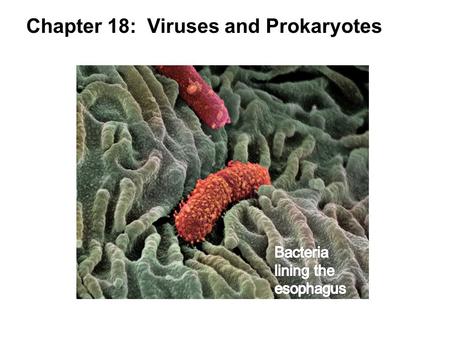 Chapter 18: Viruses and Prokaryotes