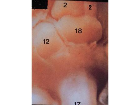 CARDIOVASCULAR SYSTEM 01 5 WEEK HEART: Identify the following: UNSEPARATED ATRIUM (2), UNSEPARATED VENTRICLE (18), LIVER (12), UMBILICAL VEIN (17), TRANSVERSE.