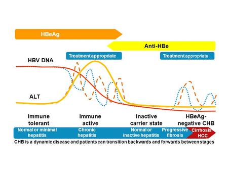 Treatment appropriate Normal or minimal hepatitis Chronic hepatitis Normal or inactive hepatitis Progressive fibrosis Cirrhosis HCC HBeAg Anti-HBe HBV.