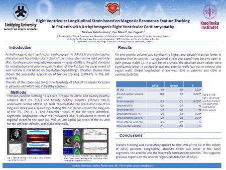 Contact information: Meriam Åström Aneq, MD, PhD Arrhythmogenic right ventricular cardiomyopathy (ARVC) is characterized by.