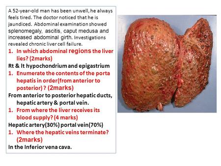 A 52-year-old man has been unwell, he always feels tired. The doctor noticed that he is jaundiced. Abdominal examination showed splenomegaly, ascitis,