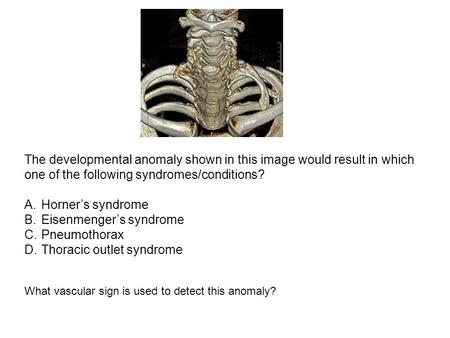 The developmental anomaly shown in this image would result in which one of the following syndromes/conditions? A.Horner’s syndrome B.Eisenmenger’s syndrome.