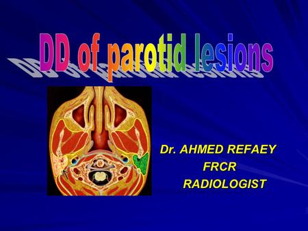 DD of parotid lesions Dr. AHMED REFAEY FRCR RADIOLOGIST.