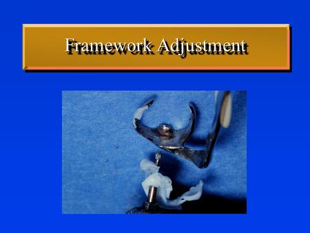 Framework Adjustment. RPD Framework Fabrication Prepare Master Cast –Place blockout in undercuts -Below heights of contour -Minor connector & lingual.