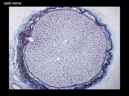 optic nerve Striate Cortex (V1) Hubel & Wiesel 1 deg.