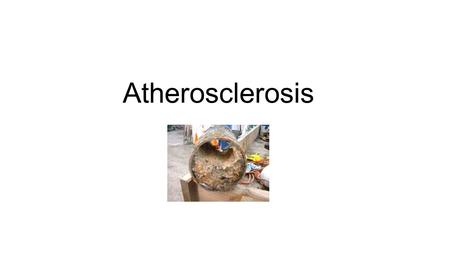 Atherosclerosis.