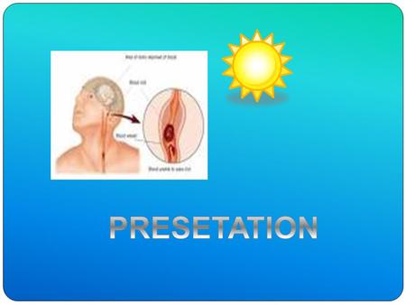 WHAT IS SUN STROKE? Sunstroke is a life –threatening condition in which the bodys heat regulating system fails, due to exposure to high temperature.