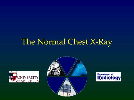 The Normal Chest X-Ray.