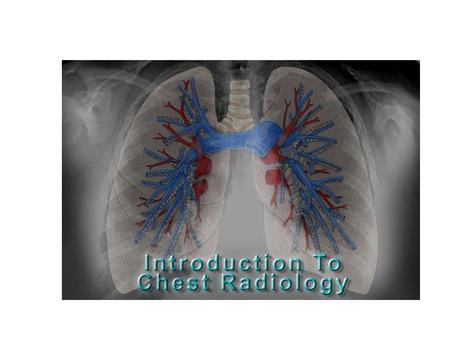 Terminology in Chest XRays PA view- chest close to xray plate xray tube 6 feet from patient Pt erect AP view- back close to plate xray tube 3 feet from.