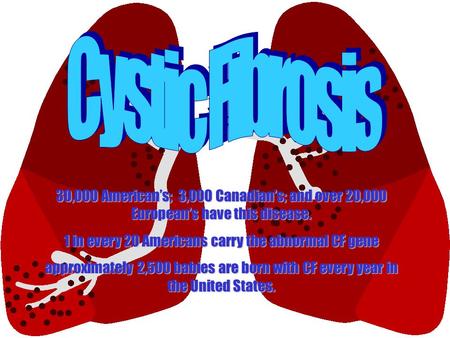 30,000 American’s; 3,000 Canadian’s; and over 20,000 European’s have this disease. 1 in every 20 Americans carry the abnormal CF gene approximately 2,500.