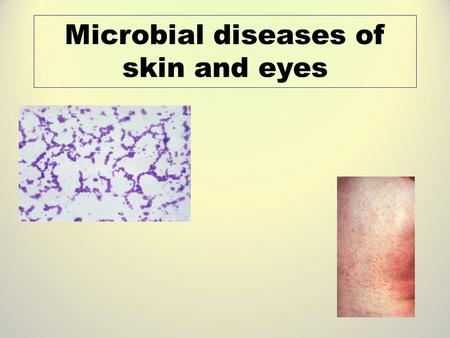 Microbial diseases of skin and eyes