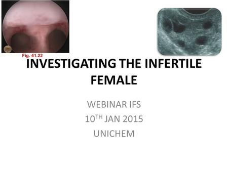 INVESTIGATING THE INFERTILE FEMALE WEBINAR IFS 10 TH JAN 2015 UNICHEM.