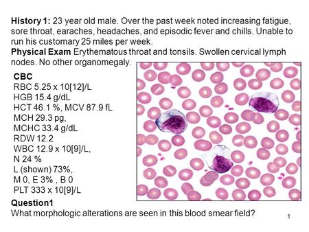 History 1: 23 year old male. Over the past week noted increasing fatigue, sore throat, earaches, headaches, and episodic fever and chills. Unable to run.