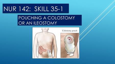 POUCHING A COLOSTOMY OR AN ILEOSTOMY