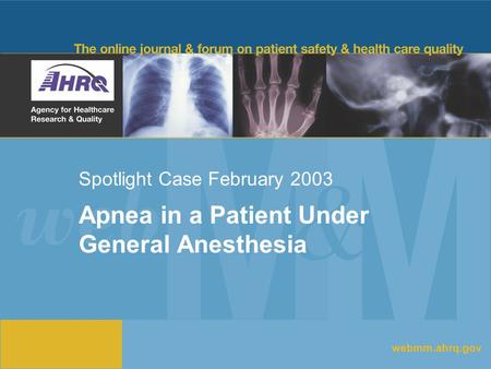 Spotlight Case February 2003 Apnea in a Patient Under General Anesthesia webmm.ahrq.gov.