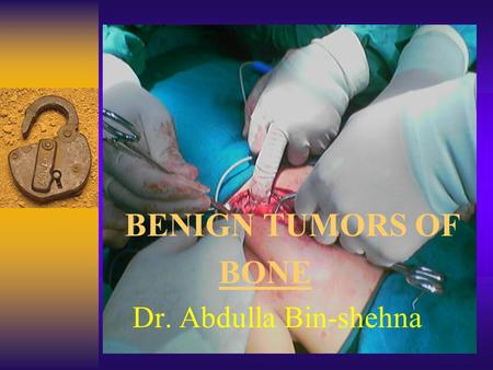 BENIGN TUMORS OF BONE Dr. Abdulla Bin-shehna. BENIGN TUMARS OF BONE 1-cystic lesions 2-fibrous lesions 3-cartilaginous lesions 4-benign (occasionally.