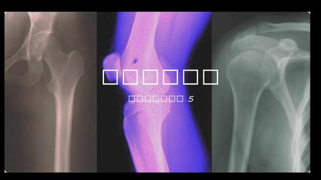 Joints Chapter 5. Joints Articulation : sites where two or more bones meet ( also called “ arthrosis ”) Functions Hold bones together securely Give skeleton.