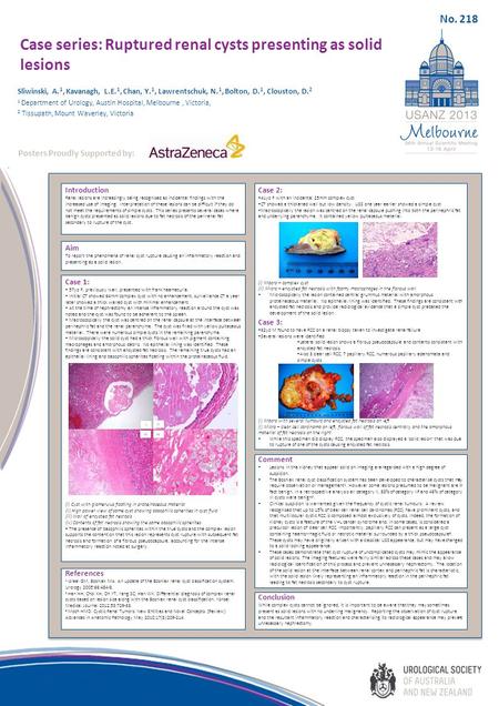 Case series: Ruptured renal cysts presenting as solid lesions Introduction Renal lesions are increasingly being recognised as incidental findings with.