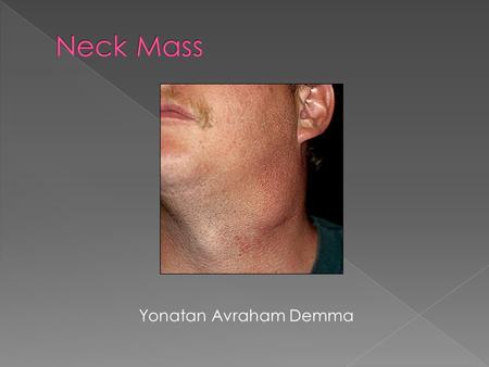 Neck Mass Yonatan Avraham Demma.